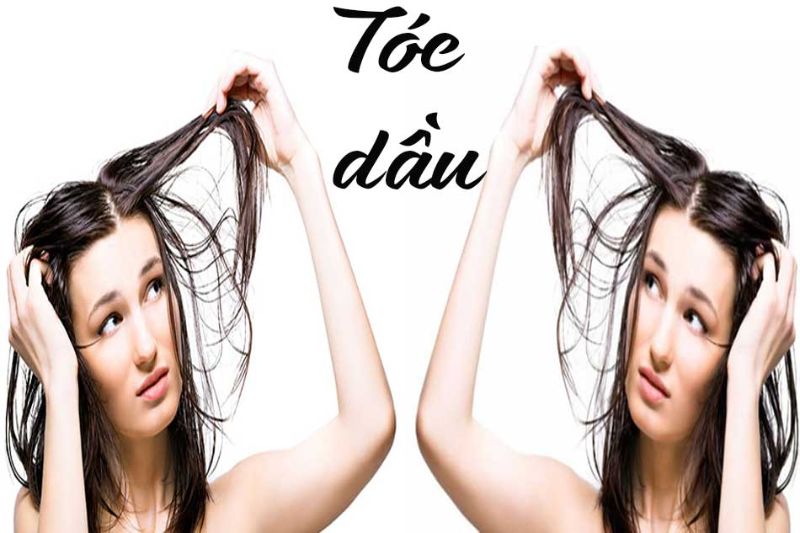 Top 10 dầu gội đầu cho tóc dầu