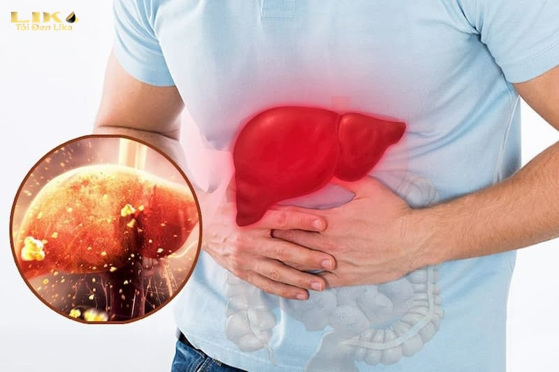 ăn tỏi đen có tốt cho gan không