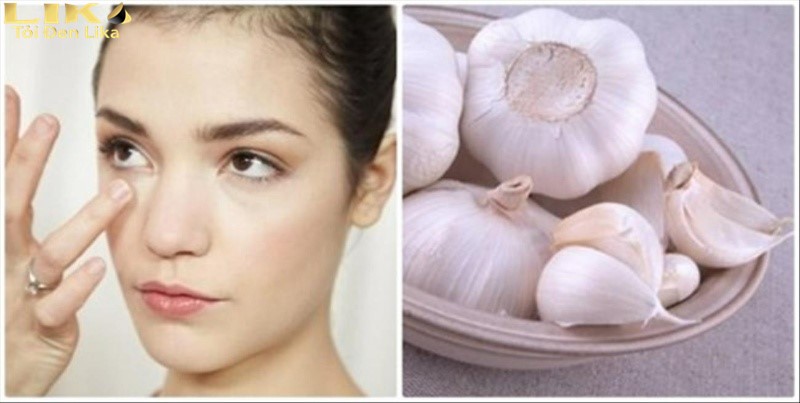 Cách trị mụn bằng tỏi không ít người áp dụng đem lại hiệu quả
