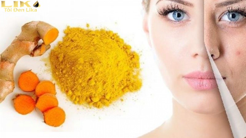 Phương pháp trị mụn bằng tỏi tươi và bột nghệ